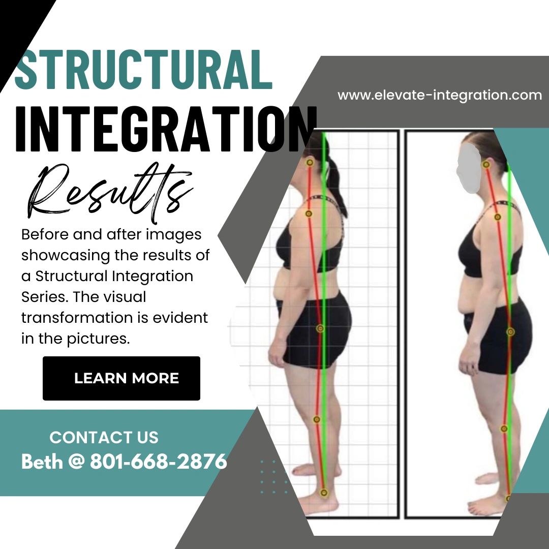 Structural Integration before-and-after posture results